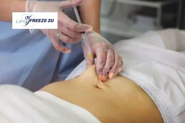How Does Aqualyx Fat Dissolving Injection Work to Break Down Fat Ilford?