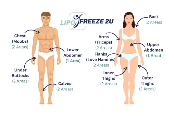 Areas you can have fat freezing treatment Ilford