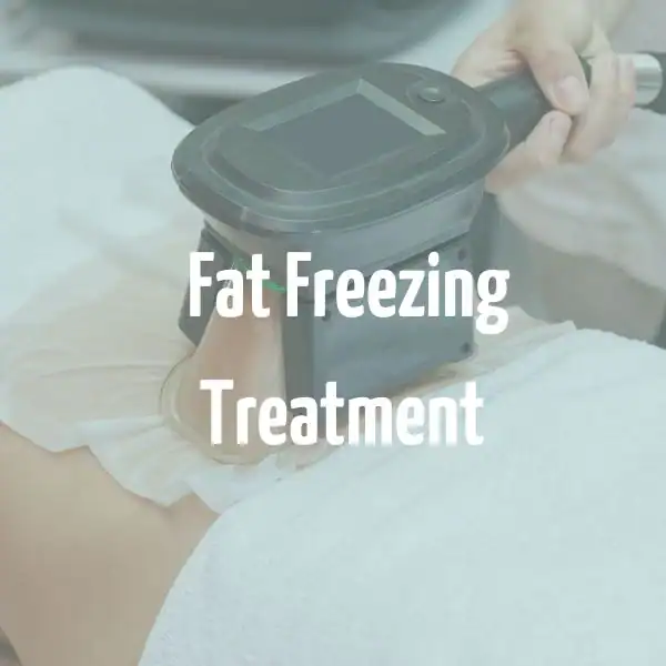 fat freezing treatment Ilford